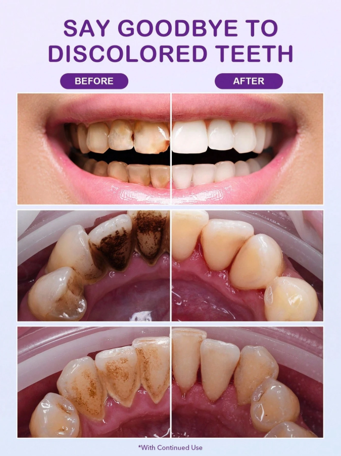 Purple Corrector Serum