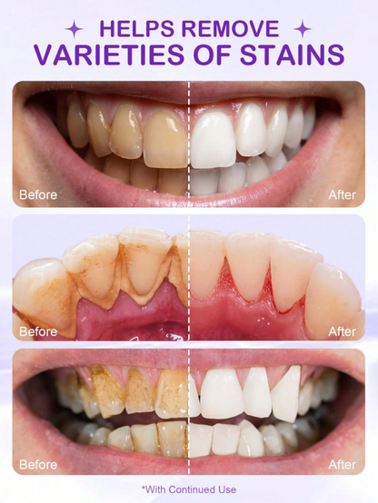 Purple Toothpowder