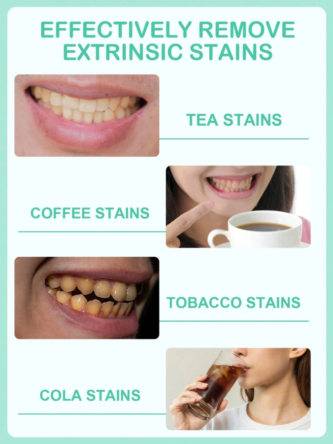 Deluxe Teeth Whitening Strips