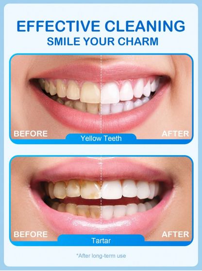 Teeth Cleaning Powder