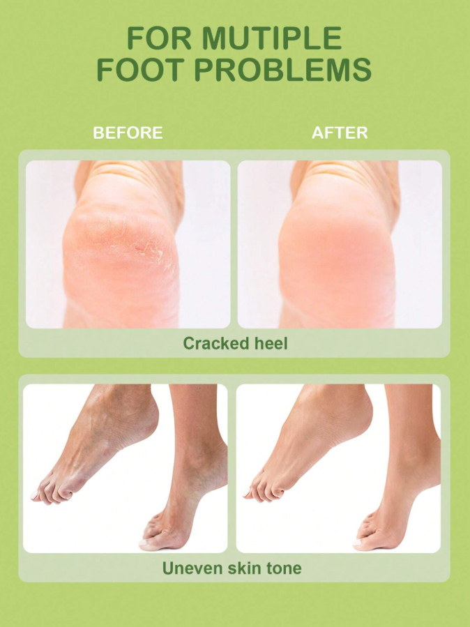 Tea Tree Foot Cream